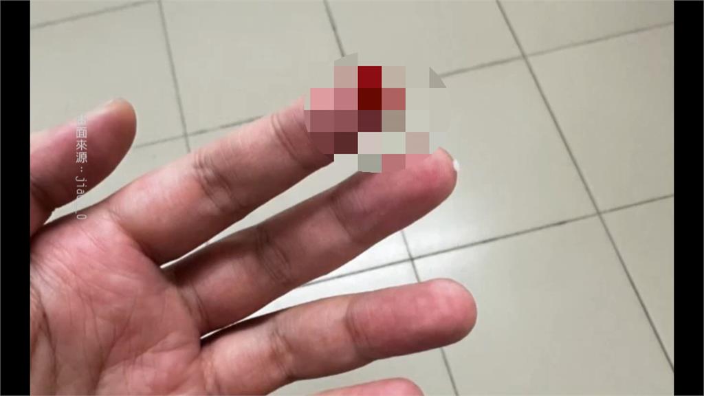 洗衣驚魂!洗衣機藏刀片 女客人手指濺血.衣物被割破