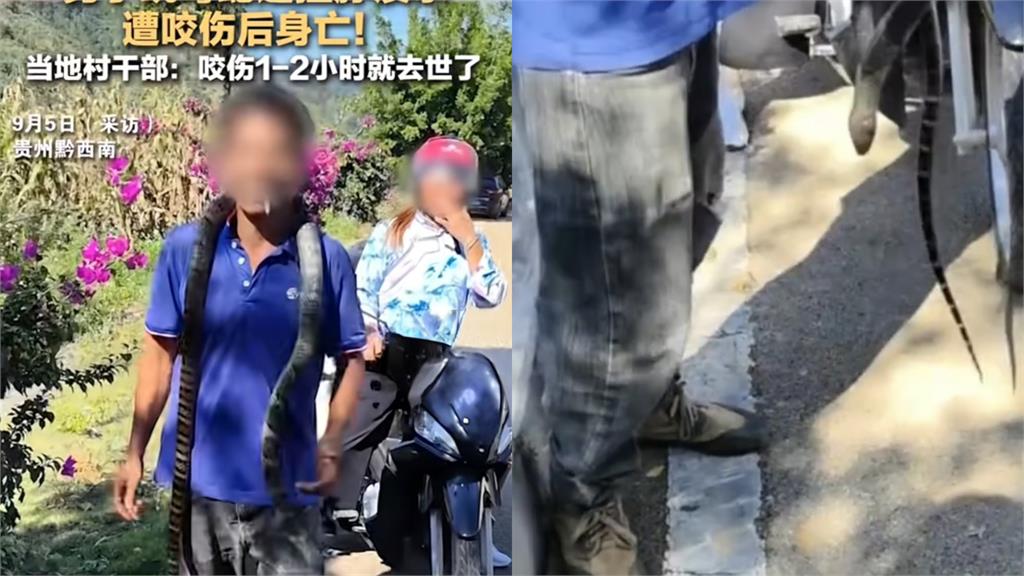 中國男子以為無毒將「眼鏡王蛇」掛脖把玩!最終被鑽褲管咬傷1小時後慘死
