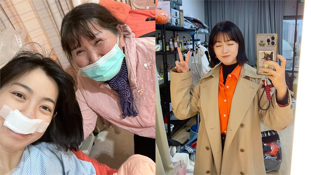 米可白燒聲賣餅被問「隆鼻手術還好嗎?」她嚇歪自清:沒有動工過