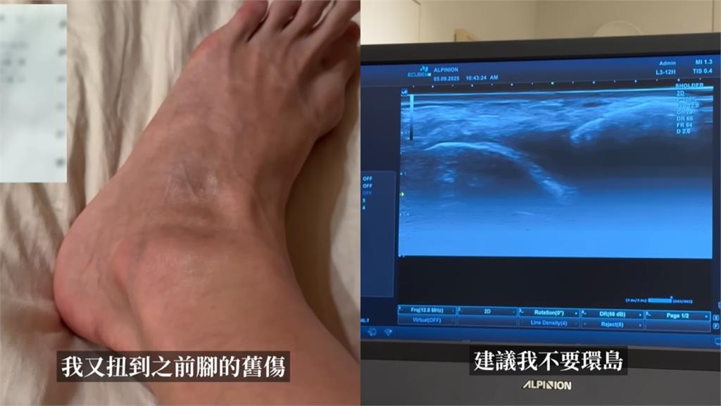 Andy騎車「險翻車超驚悚」畫面曝!含淚「脫口吐1心聲」網驚:在說家寧?