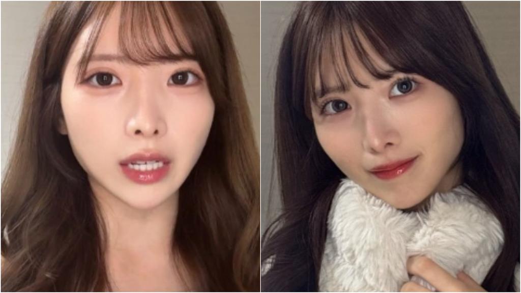 日本前女團成員「狠砸百萬整形」變超級正妹…無預警曬5年前「驚人對比照」!