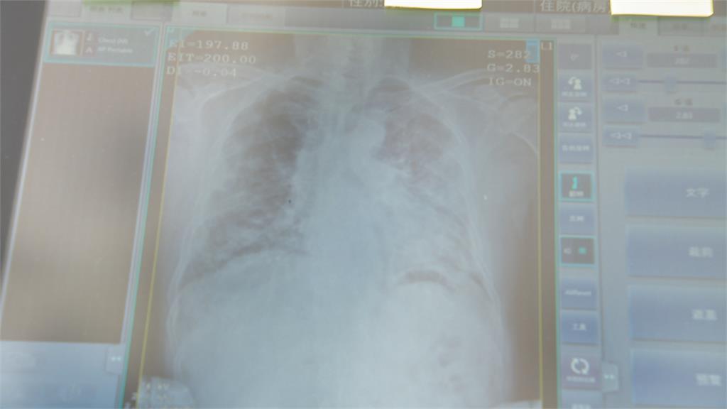 新北議員陳啟能捐移動型X光機　減少病患染疫風險