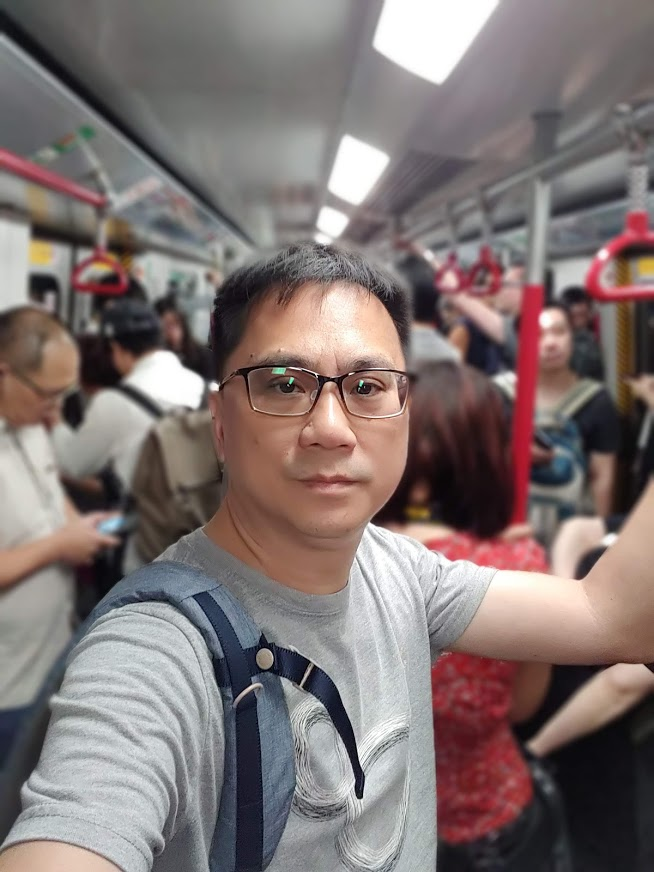 不到40歲洗腎男臉超黑！486先生一問「竟是糖尿病友」 親揭保命妙招