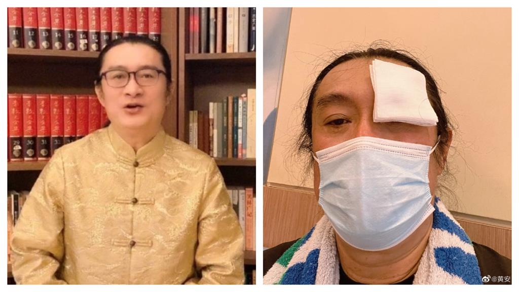 黃安「換上僧袍、頭頂全淨空」出家了?自爆「飛中國商演」出事:一張口全沒了