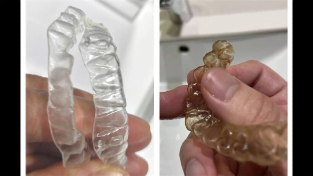 歐耐恩隱形牙套爭議延燒! 創辦人上火線說明遭火爆踢館