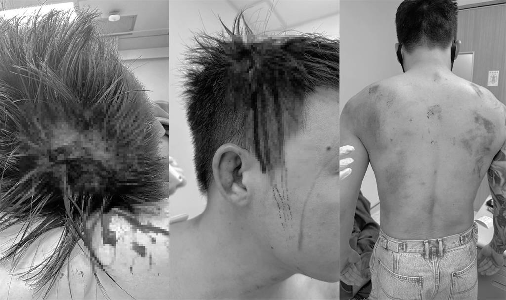 快新聞/Toyz遭超哥痛毆頭部縫10針 律師:將提告「4罪名」