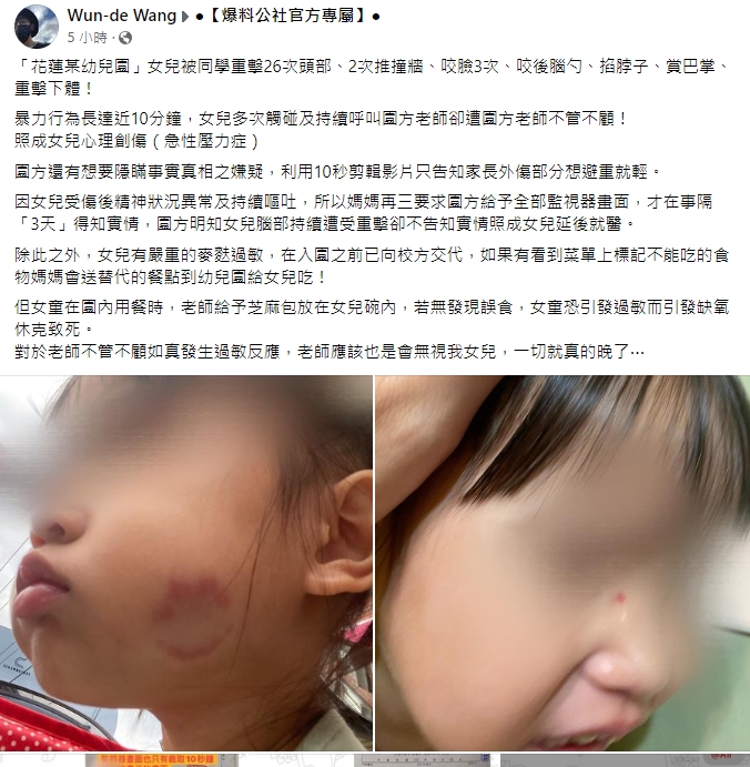 女童幼兒園遭「同儕痛打一頓」老師全不管！家長控訴：真的很心痛