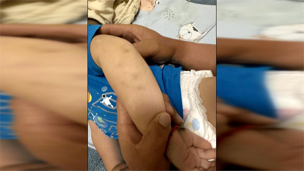 高雄幼兒園疑施虐 童曝「老師打人」6教保員停職