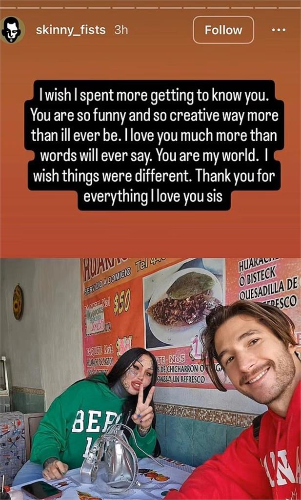 極端整形網紅「瑪達肋納」33歲驟逝!帳號突改成「詭異名字」後即傳噩耗