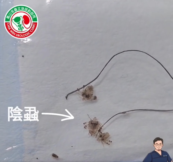 螃蟹蟲
