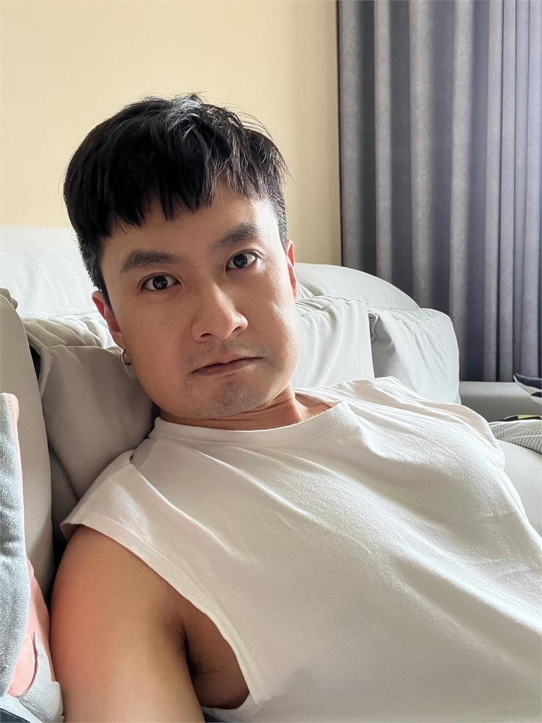 張雁名拔智齒疑傷到神經!俊帥臉蛋「腫成國字臉」嘆:不知能否復原