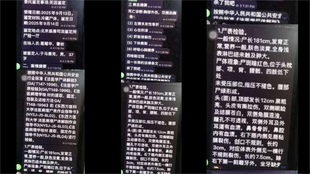 于朦朧爆「全口無牙、下體撕裂」屍檢暗網流出!「1器官神秘消失」畫面急刪外流