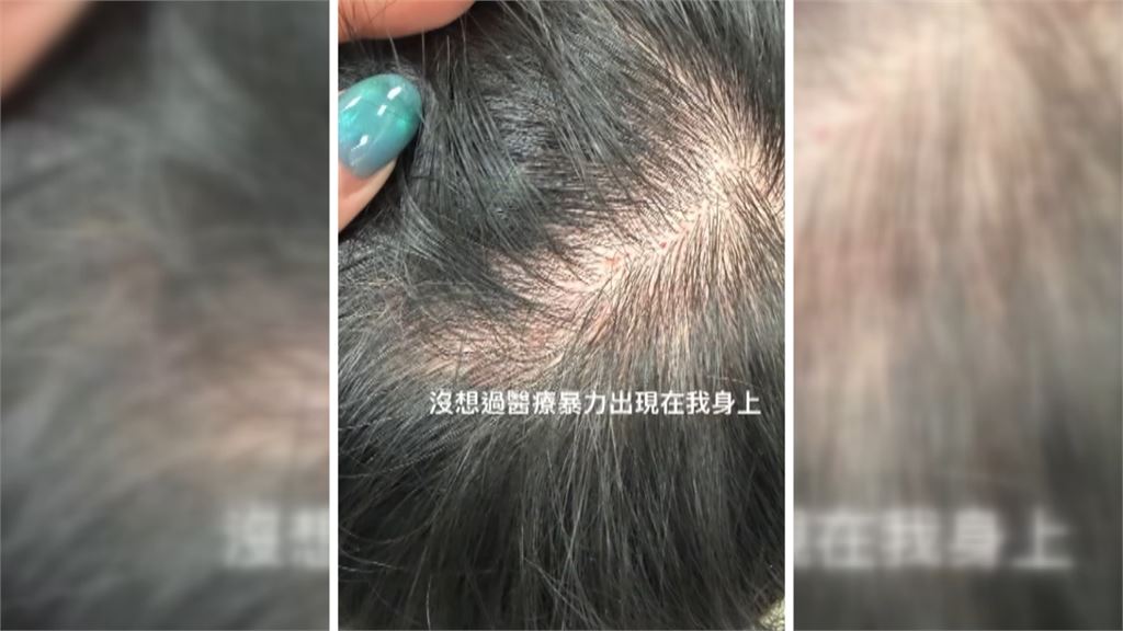 彰化傳醫療暴力! 7旬翁抽血失控"扯男護理師頭髮"