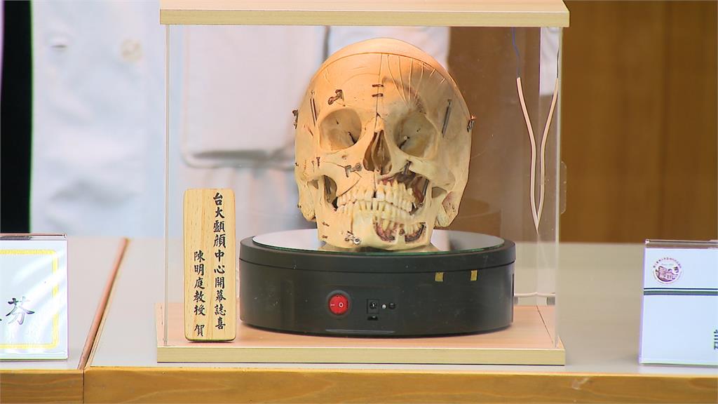 奇蹟少年!兒時被嘲笑像外星人 台大醫院花17年還他一張帥臉