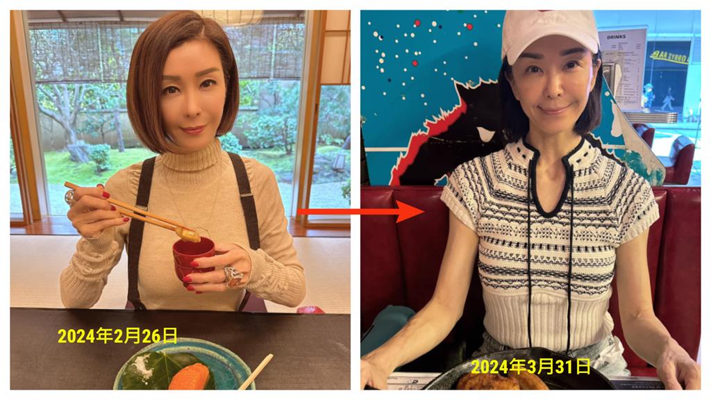昔「最上鏡亞姐」伍詠薇暴瘦成皮包骨!「脖子青筋突出」近況照嚇壞粉