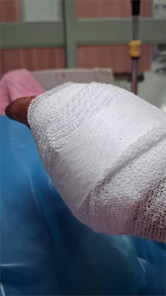 快新聞／高雄科技大廠女保全突遭男友砍！恐怖情人還放話「殺你媽媽」