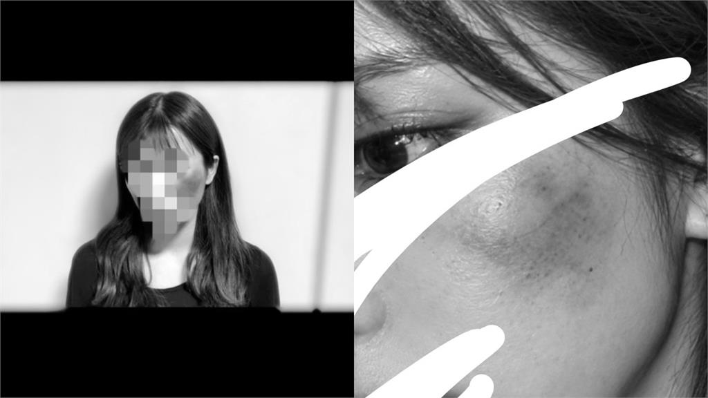 男團偶像涉嫌施暴女友！她「滿臉是血」衝超商求救…發傷勢照喊：心裡的傷痛更痛