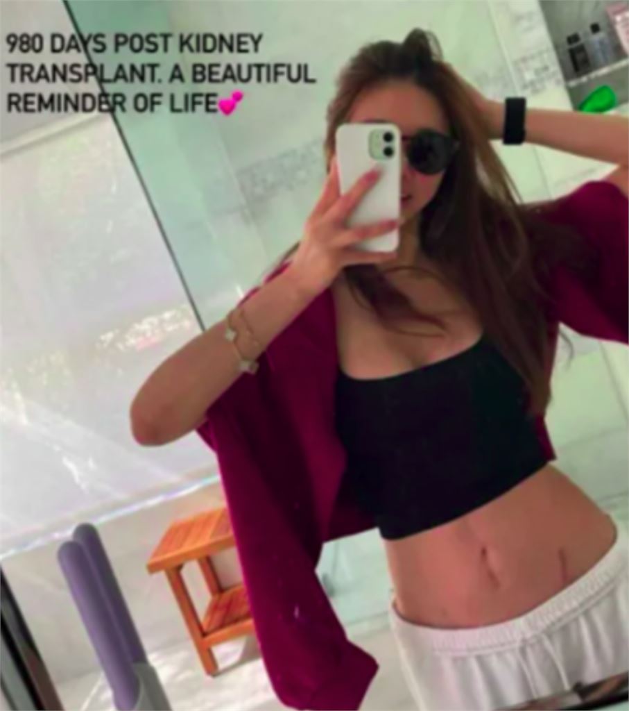 孫芸芸49歲親姊「腎臟移植980天」認了！社群突PO照「傷疤」不藏了