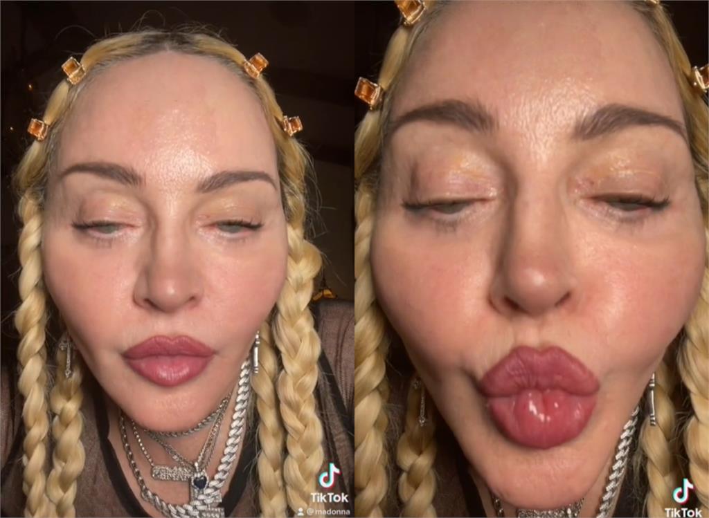 63歲瑪丹娜「眼神渙散、豐唇狂抖」！13秒自拍片曝網嚇壞：怎麼了？