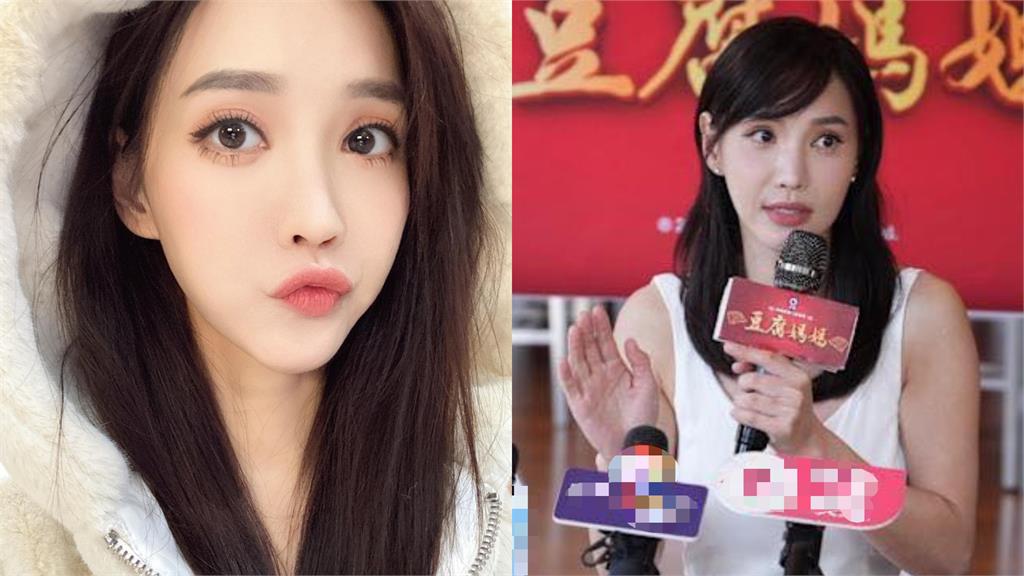 八點檔女神「車禍毀容」花500萬重塑！徐千京223字吐心聲：手術逾10次…