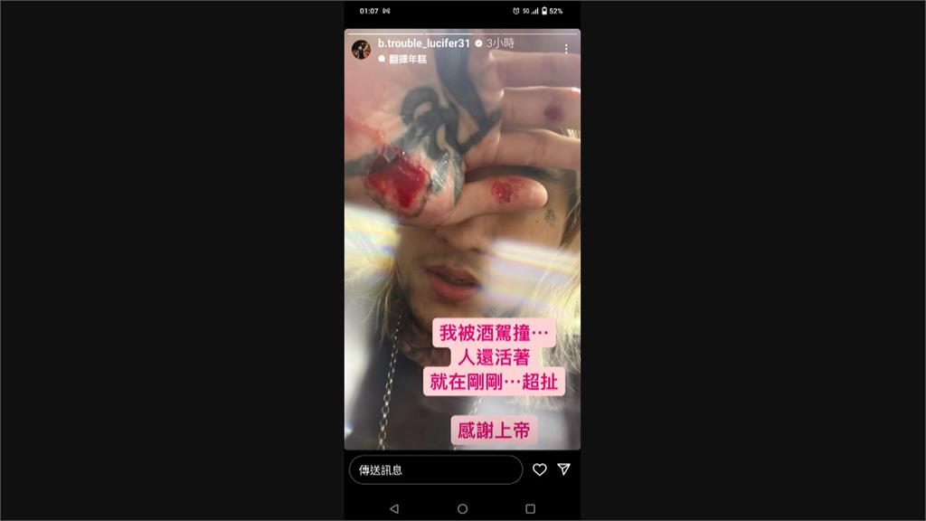 酒駕撞機車拖行1公里! 網紅騎士多處擦傷