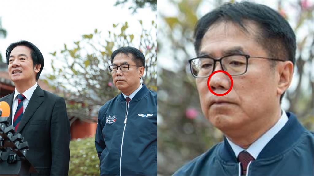 新一代「戰痘男神」誕生？黃偉哲曬「清晰私照」湧15萬人朝聖：還很青春耶