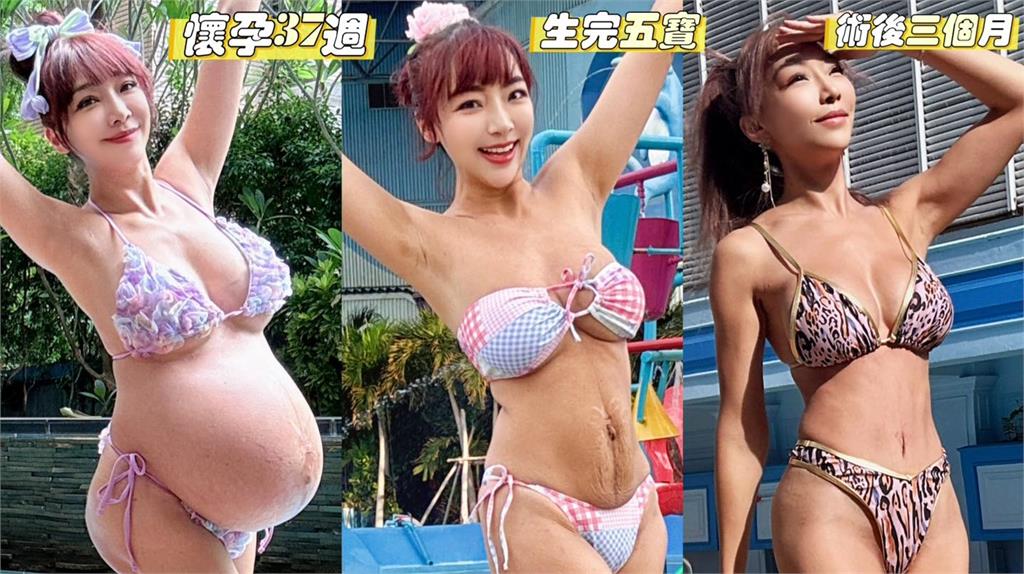 台大辣媽生5胎遭酸走鐘！怒動刀縮腰「3階段超狂進化」嗆：生8寶也不怕