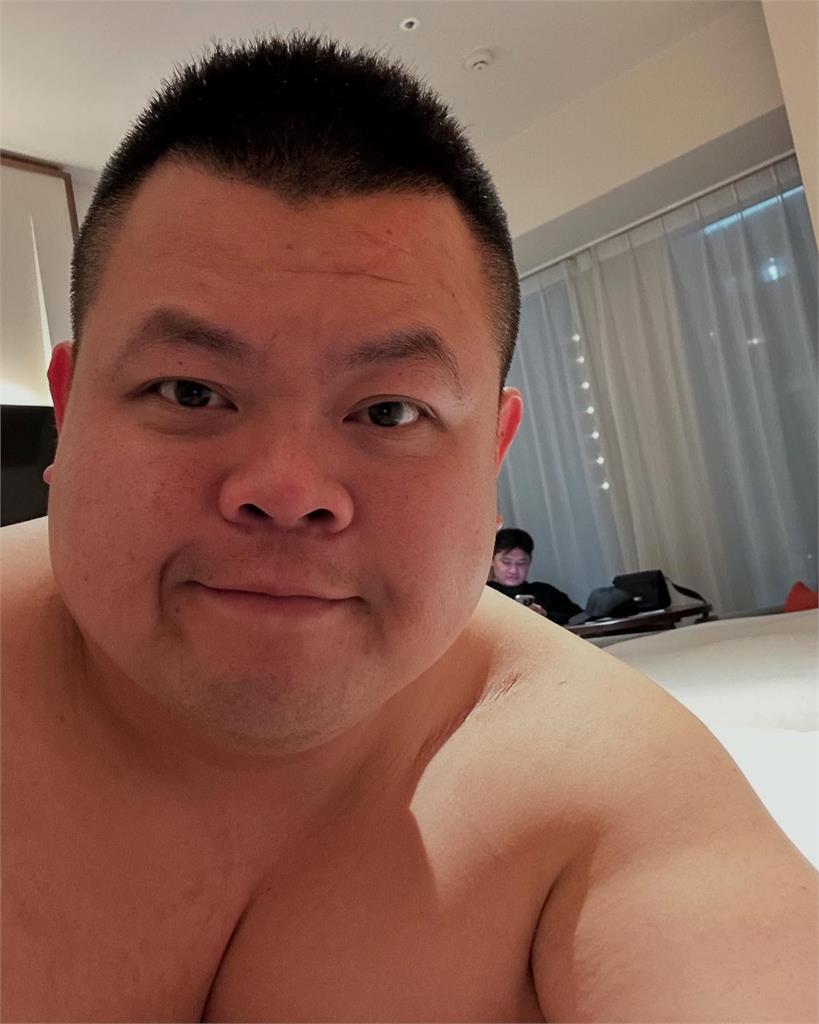 免疫門檻將調整從「BMI35變45」!醫曝實際概念:減肥前的「他」到大蛇丸
