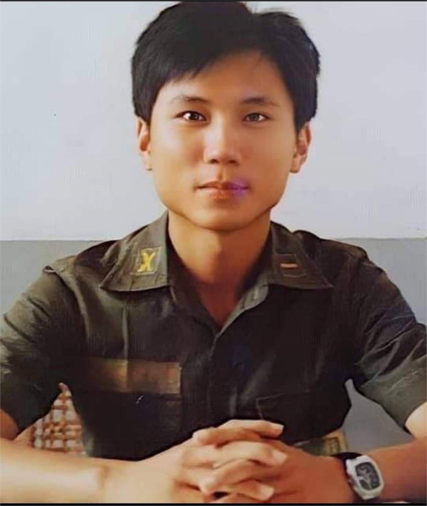 突宣布明緊急手術！詹江村「眼角膜」驚爆受損　連看3醫曝發病恐怖感受