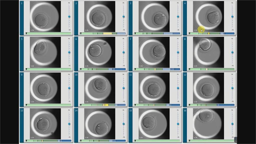 單身時就凍卵! 44歲女工程師求女成功