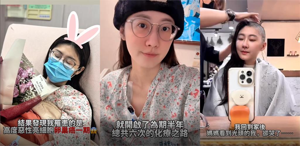 國光女神「消失半年剃光頭」爆肥20公斤！親認罹癌曝「57秒艱辛過程」網看哭
