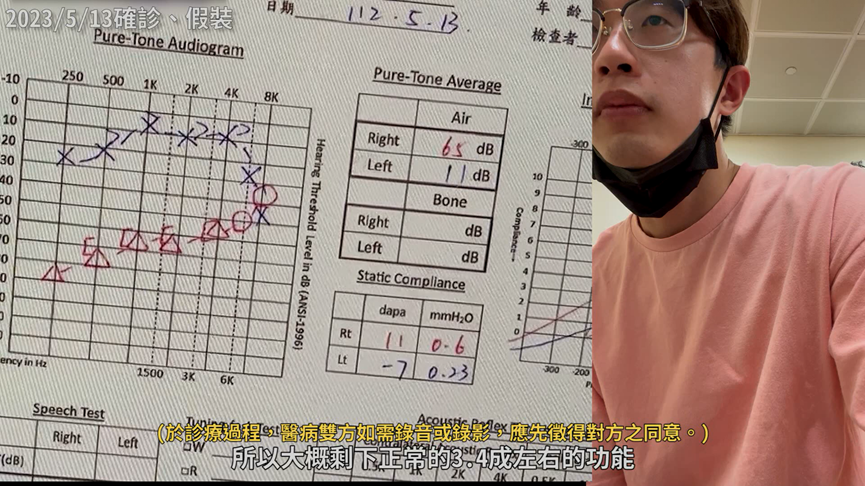 右耳功能只剩3至4成!醫師揭「突發性耳聾」經歷 悲嘆:最黑暗時刻