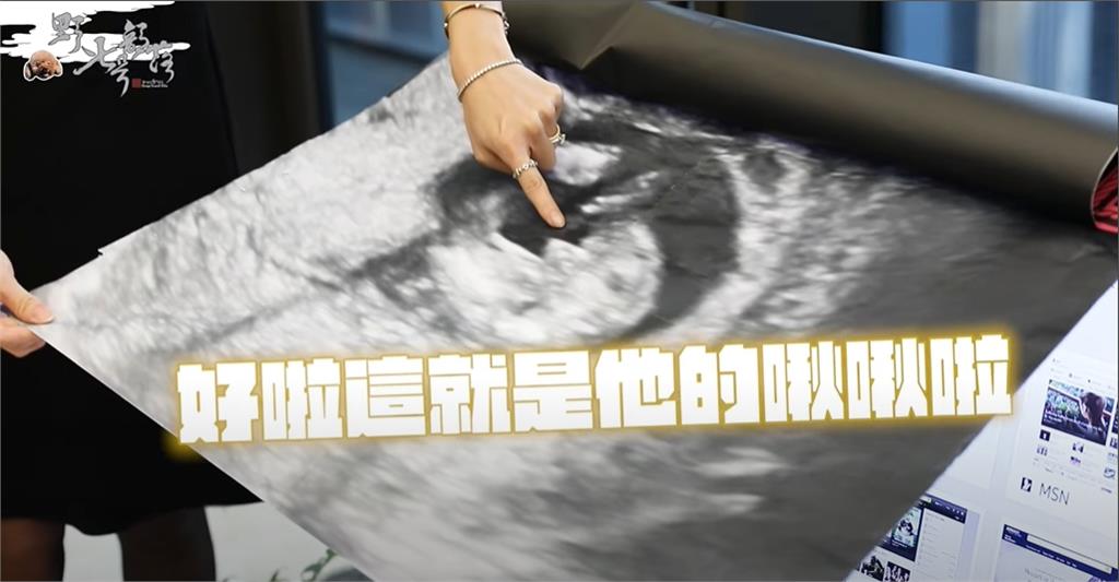 KID曬寶寶清晰超音波照!他見「小野人」1動作樂歪:在對我加油啦