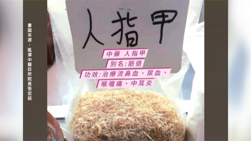 獨家/奇!人指甲竟是中藥材 中醫師:有此藥但別亂吃