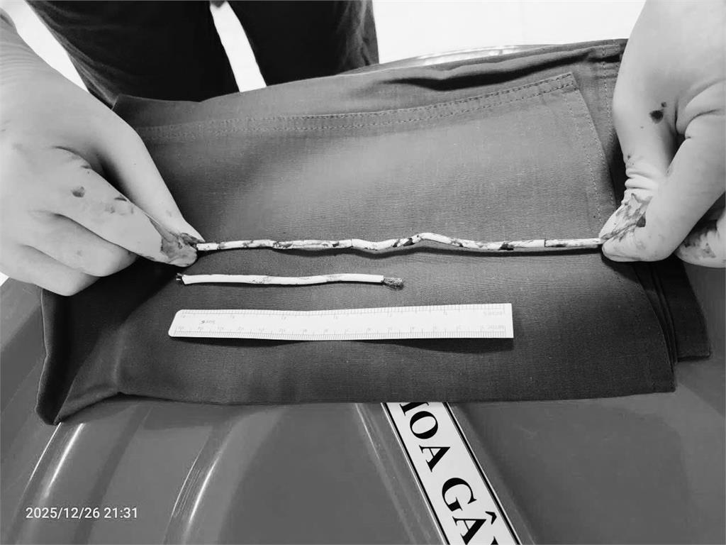 拍「挑戰片」竟將35公分網路線插尿道！15歲少年「GG腫脹、出血」急送醫