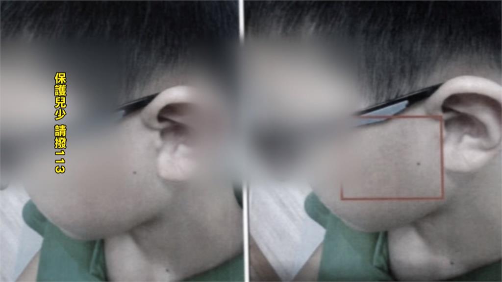 超扯！國小躲避球竟打到腦震盪？　學童曝代課老師K人「躲了會被罰」