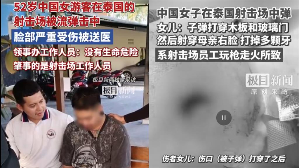 射擊場爆流彈意外!中國女遊客遭擊中臉部「子彈穿臉留黑洞」驚悚照片曝光