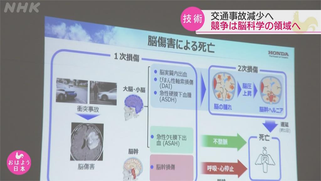 用大腦科學預防車禍　MRI核磁共振分析駕駛習慣動作