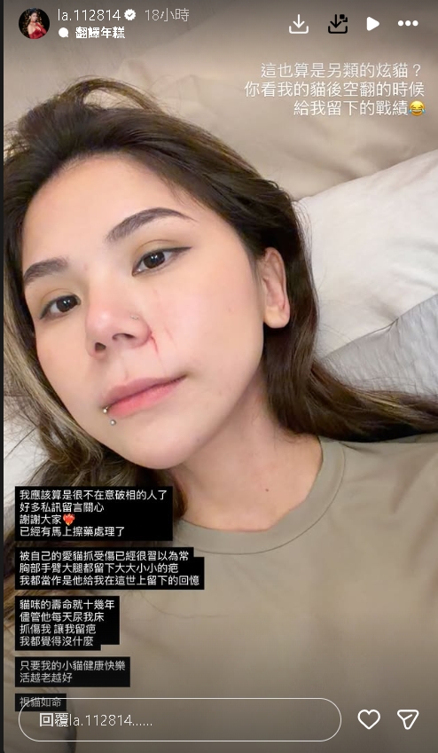 蕾菈遭突襲「半張臉被抓傷」險毀容!竟是「1片段惹事」驚悚過程曝:好扯…