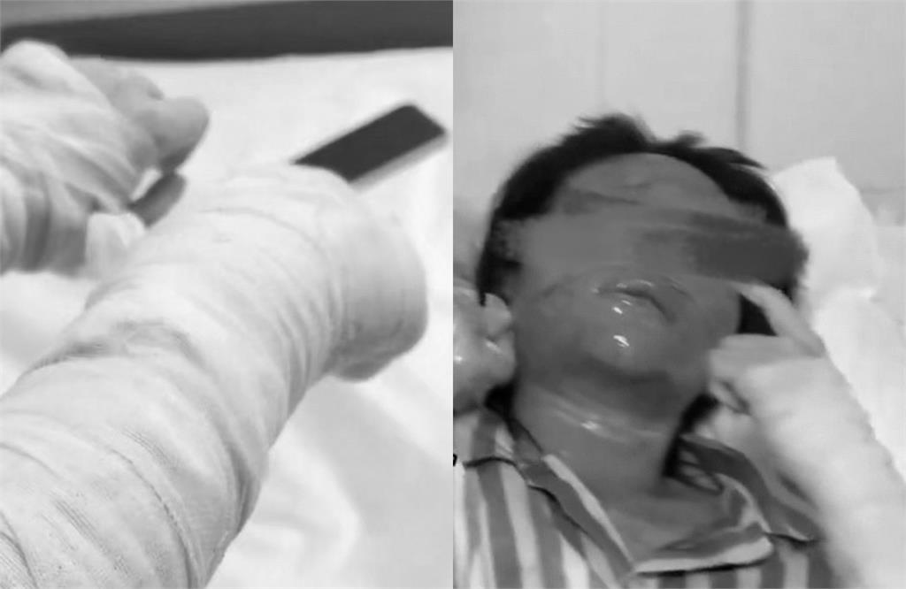 正妹實況主「收包裹秒爆炸」美顏全毀!「正面只剩一條線」她不忍曝真凶照發聲了