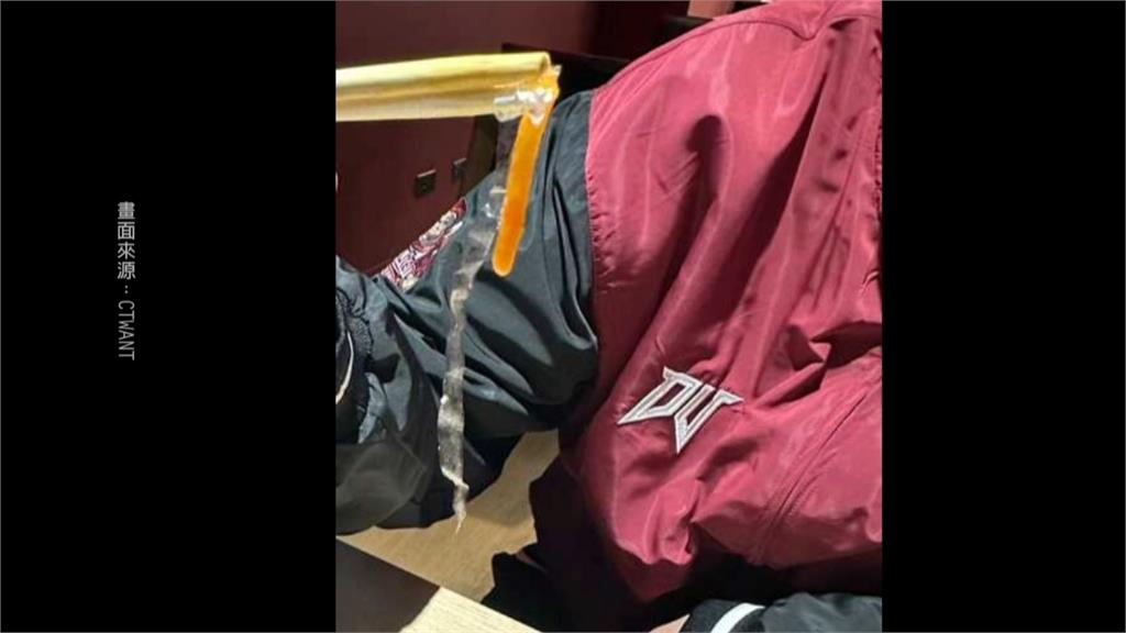 又出包? 球員餐有「死蒼蠅、活蛆」 樂天桃猿:要求廠商加強衛生