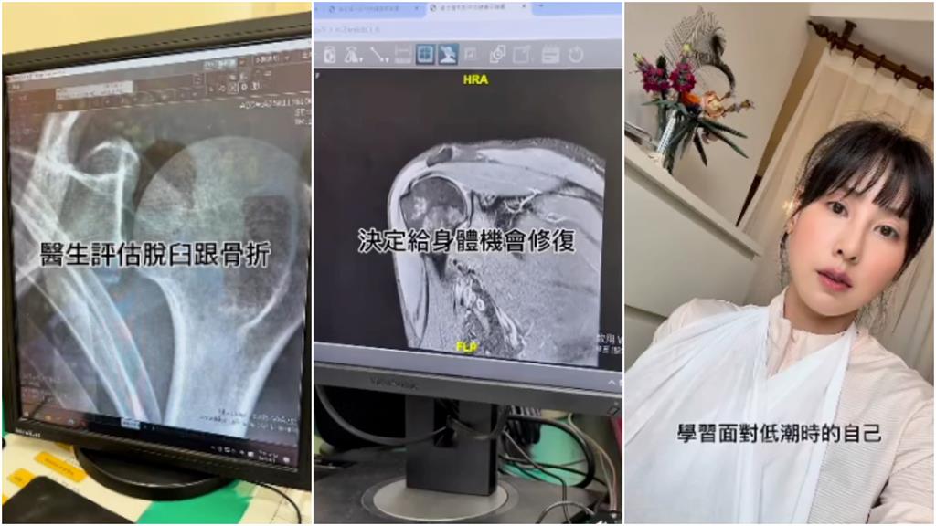 女神房思瑜「40歲狀態大鬼轉」認陷低潮!淚崩全被錄:痛到不行有陰影