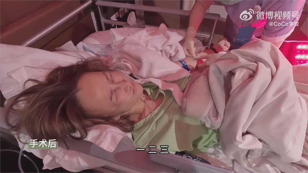 李玟「左腿天生缺陷」手術影片曝　曾自稱女戰士對抗病魔