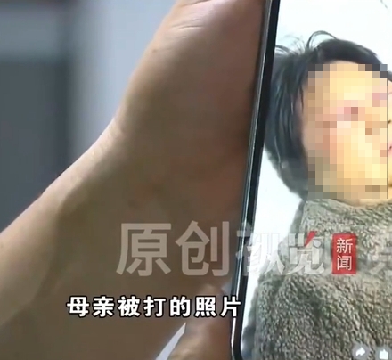 肋骨