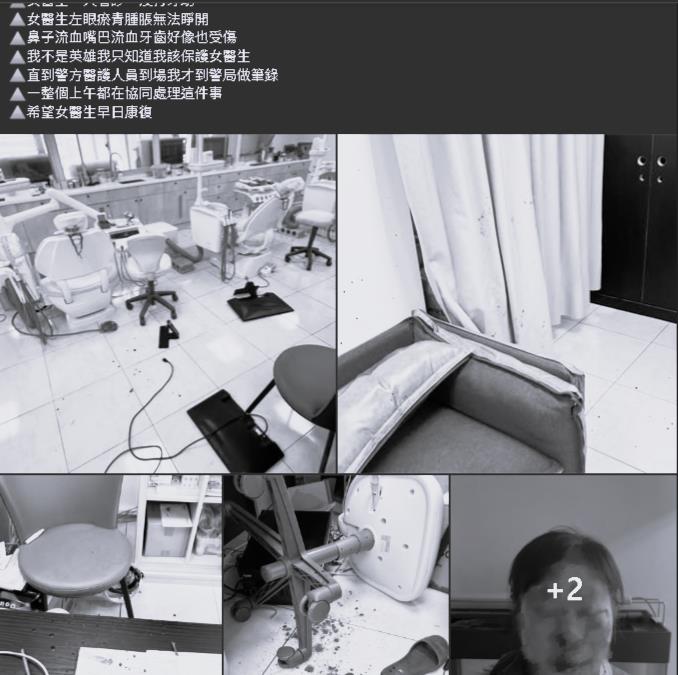 20歲壯男因「洗牙太痛」怒開揍!女牙醫「全臉腫翻」慘況曝光