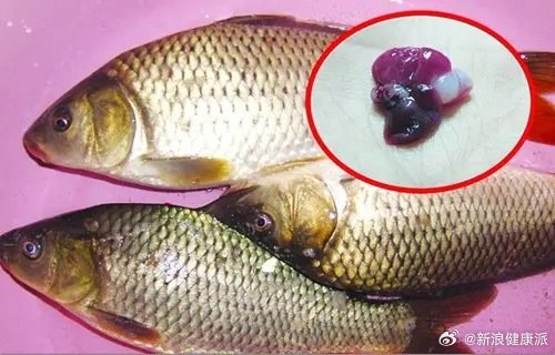 女子偏頭痛聽信偏方「生吞1物」急送醫!醫警告:比砒霜還危險、且無解毒藥