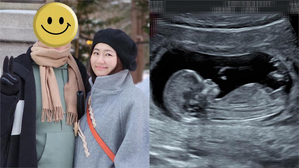Selina產前大解放!倒影狂洩「肉感泳裝」 Selina產前解放「肉感泳裝」!倒影洩「暴風膨脹」笑喊:怕噴鼻血