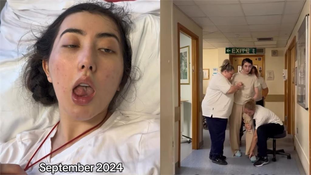 英國女旅遊突中風醒來變「濃厚泰國腔」!醫驚:是罕病「外國口音症候群」