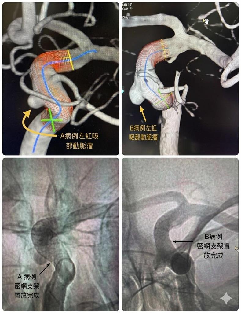 聯新國際醫院陳啟仁：2好友同地點動脈瘤，前老闆40歲猝逝竟是關鍵？