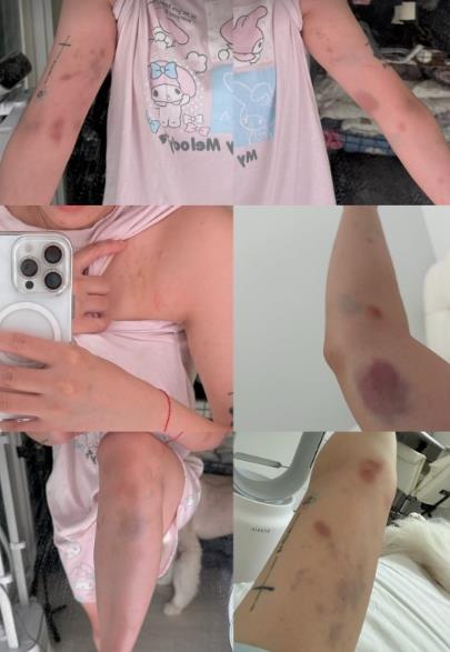 快新聞/恐怖!台網紅拒搭訕竟遭韓男施暴 外交部:已與當地警方聯繫